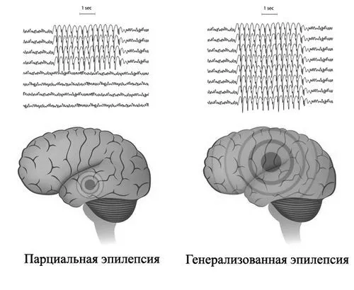 лікування