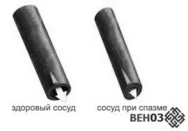 головного