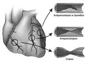 симптоми