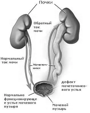 причини