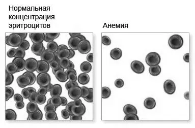 лікування