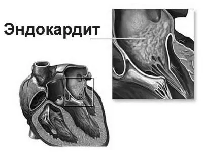 серця
