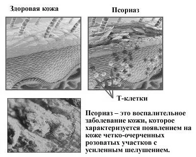 хвороби
