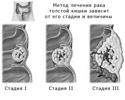 кишки