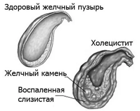 симптоми