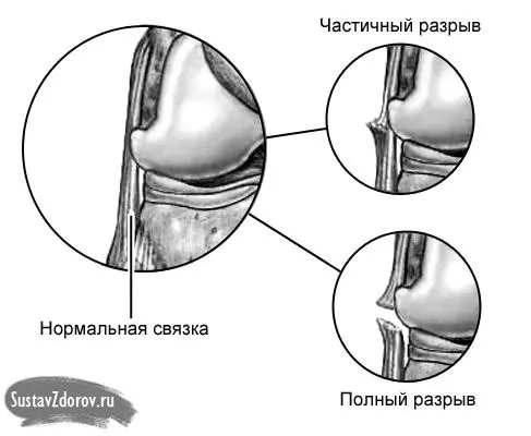 причини