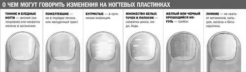 симптоми