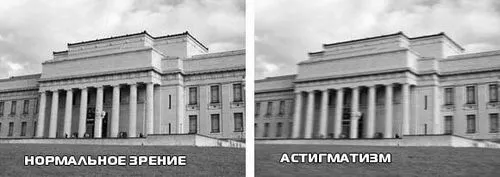 як лікувати миопический астигматизм