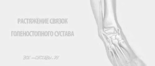 розтягнення зв'язок гомілковостопного суглоба лікування симптоми