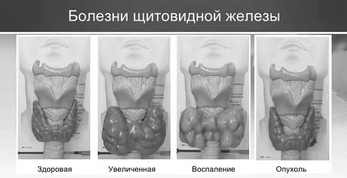 жінок