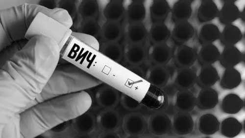 як лікуватися від ВІЛ