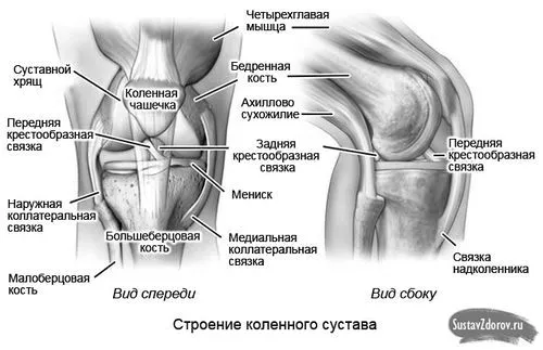 як лікувати розтягнення хрестоподібних зв'язок