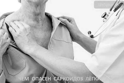лімфовузол