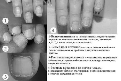 нігті