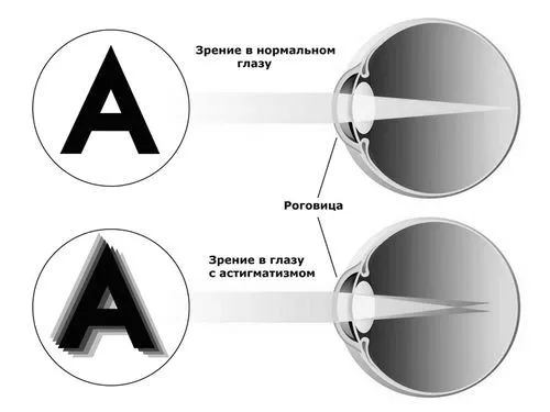 простий