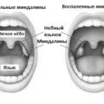 лікування