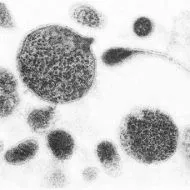 urealyticum