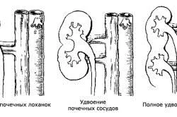 ознаки