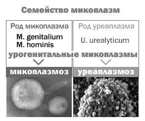 уреаплазма