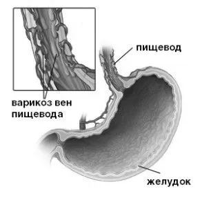 лікування
