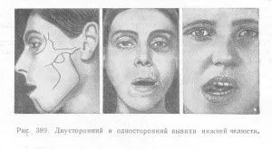 зміщення