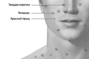 хвороба