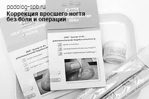 Вріс ніготь на нозі ніготь