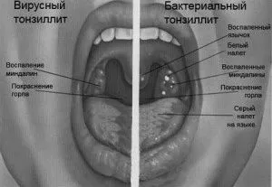 горлі