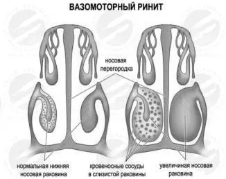 лікування