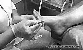доглядати