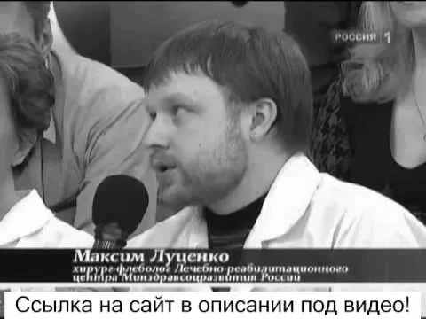 варикоз
