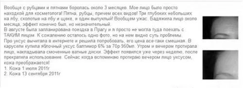 Оцет від прищів - яблучний, для особи, застосування, від плям, після, відгуки застосування