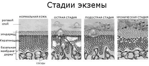 ногах