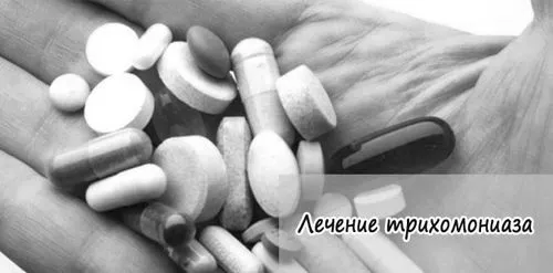 трихомоніаз