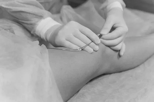ногах
