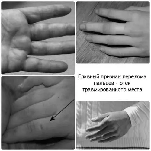 пальця