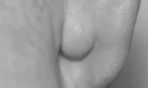 вухом