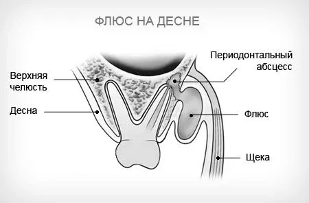 лікування