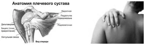 Защемлення плечового нерва: симптоми і чим лікувати в домашніх умовах плечового