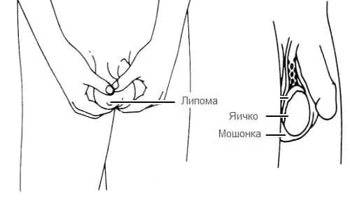мошонці
