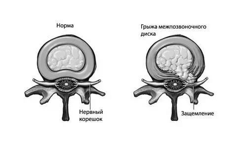нерва