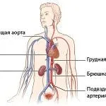 Печія в горлі: причини, симптоми печії в горлі після їжі як лікувати печію в горлі