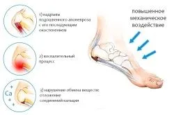 ніж вилікувати ногу