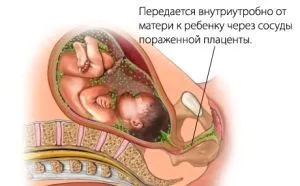 сифіліс на губах фото