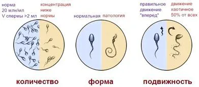 Чоловіче безпліддя - причини і лікування народними засобами чоловічі захворювання