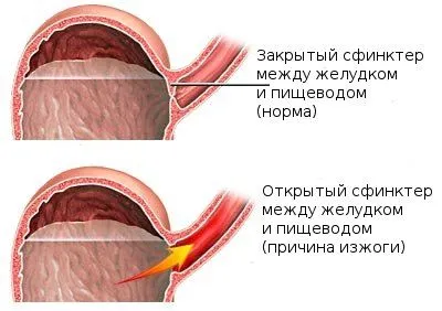 причини