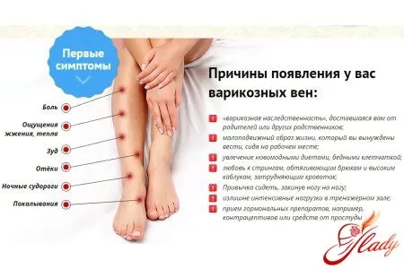 як лікувати варикоз ніг в домашніх умовах