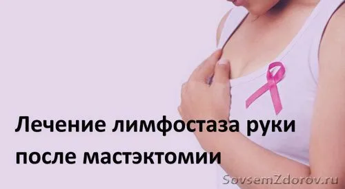 як лікувати лімфостаз після мастектомії