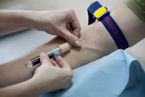 побутовий сифіліс симптоми