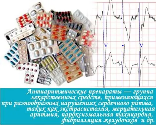 Як лікувати аритмію серця: ліки як лікувати аритмію серця